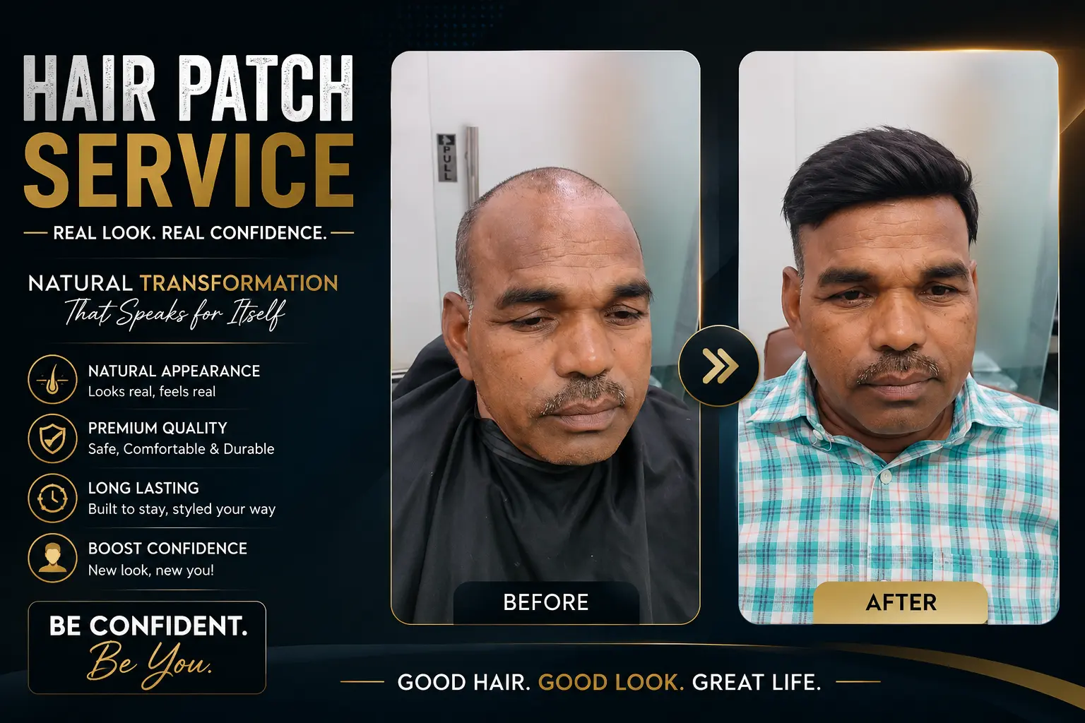 Hair patch service transformation showing a client before and after fitting